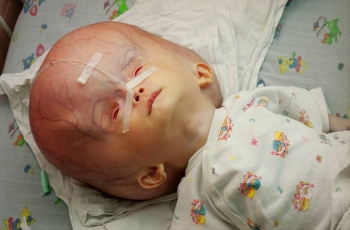 Loạt ảnh kinh hoàng về nạn nhân chất độc da cam